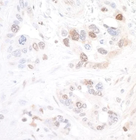 Immunohistochemistry (Formalin/PFA-fixed paraffin-embedded sections) - Anti-Visfatin antibody [BLR058F] (AB252558)