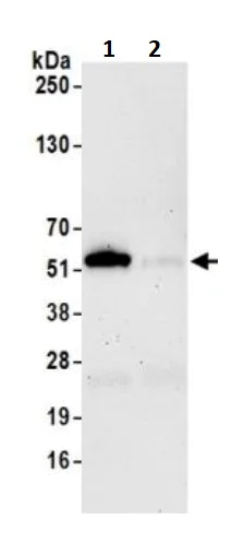 Immunoprecipitation - Anti-Visfatin antibody [BLR058F] (AB252558)