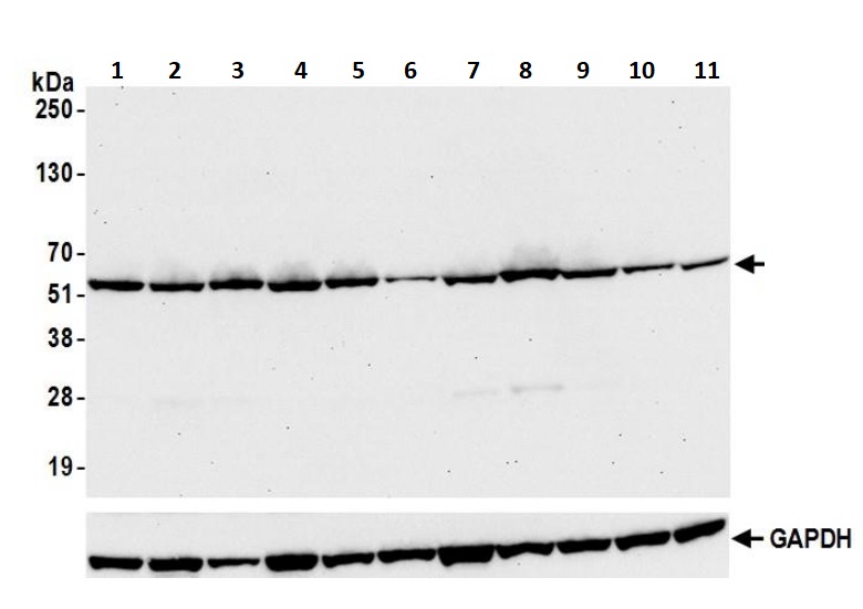 Western blot - Anti-Visfatin antibody [BLR058F] (AB252558), expandable thumbnail
