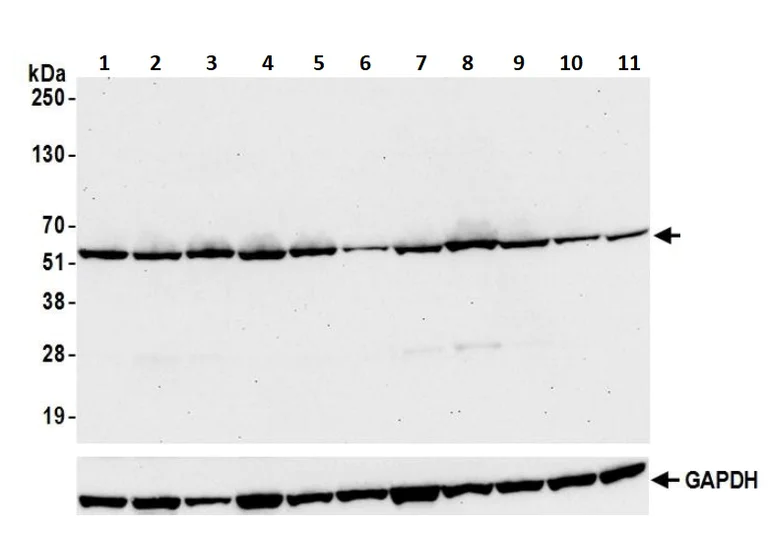 Western blot - Anti-Visfatin antibody [BLR058F] (AB252558)