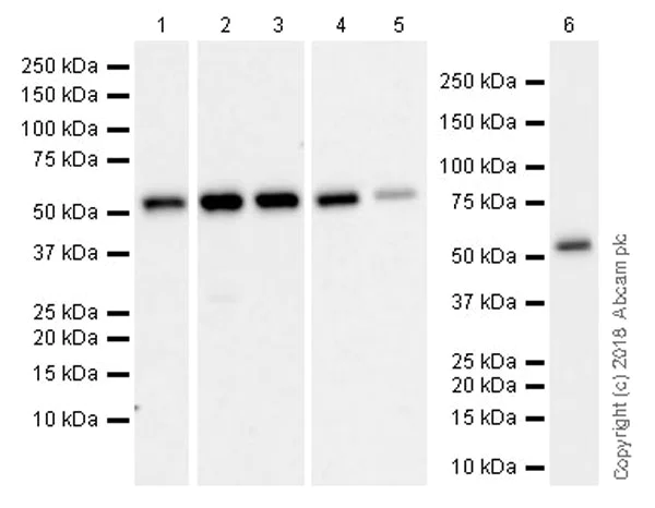 Western blot - Anti-Visfatin antibody [EPR21980] (AB236874)