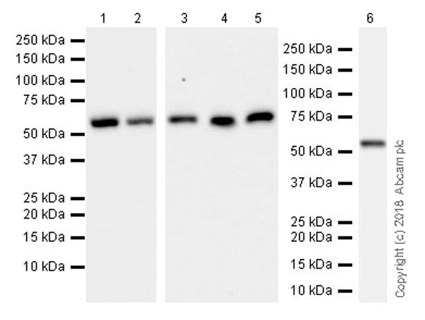 Western blot - Anti-Visfatin antibody [EPR21980] (AB236874)
