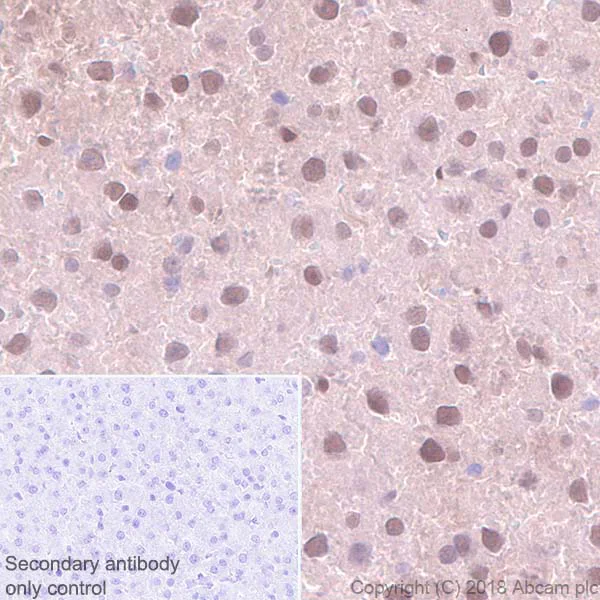 Immunohistochemistry (Formalin/PFA-fixed paraffin-embedded sections) - Anti-Visfatin antibody [EPR21980] - BSA and Azide free (AB240589)