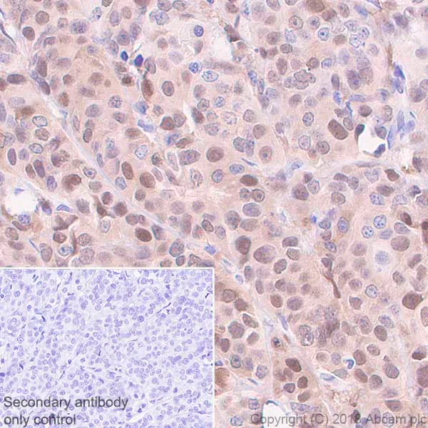 Immunohistochemistry (Formalin/PFA-fixed paraffin-embedded sections) - Anti-Visfatin antibody [EPR21980] - BSA and Azide free (AB240589)