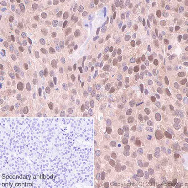 Immunohistochemistry (Formalin/PFA-fixed paraffin-embedded sections) - Anti-Visfatin antibody [EPR21980] - BSA and Azide free (AB240589)