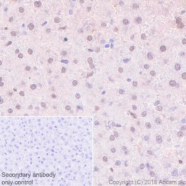 Immunohistochemistry (Formalin/PFA-fixed paraffin-embedded sections) - Anti-Visfatin antibody [EPR21984] (AB236873)