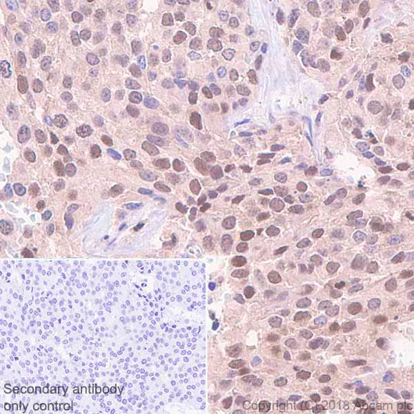 Immunohistochemistry (Formalin/PFA-fixed paraffin-embedded sections) - Anti-Visfatin antibody [EPR21984] (AB236873)