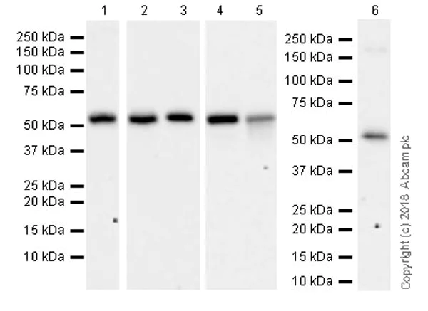 Western blot - Anti-Visfatin antibody [EPR21984] (AB236873)