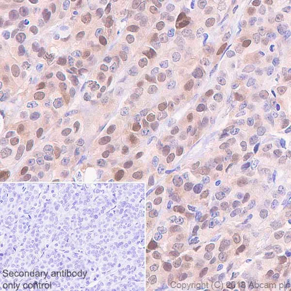Immunohistochemistry (Formalin/PFA-fixed paraffin-embedded sections) - Anti-Visfatin antibody [EPR21984] - BSA and Azide free (AB240560)