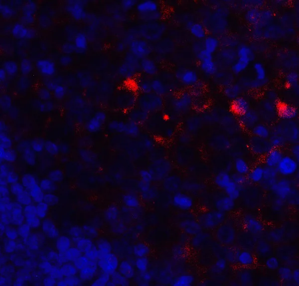 Immunocytochemistry/ Immunofluorescence - Anti-VISTA antibody (AB254581)