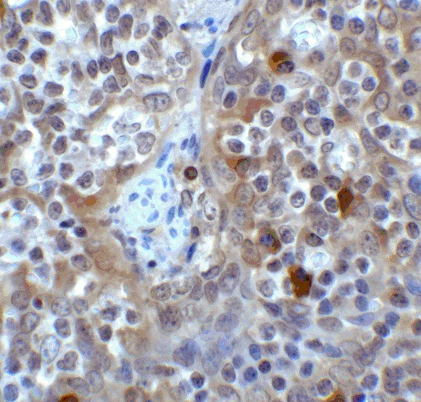 Immunohistochemistry (Formalin/PFA-fixed paraffin-embedded sections) - Anti-VISTA antibody (AB254581)