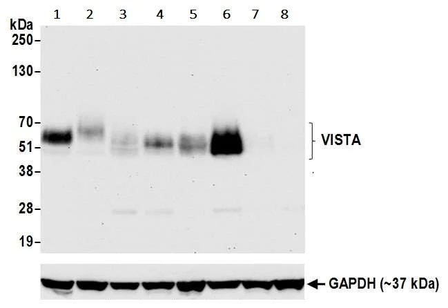 Western blot - Anti-VISTA antibody [BLR035F] (AB243891)