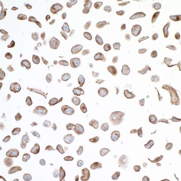Immunocytochemistry - Anti-VISTA antibody [BLR035F] - BSA free (AB272080), expandable thumbnail