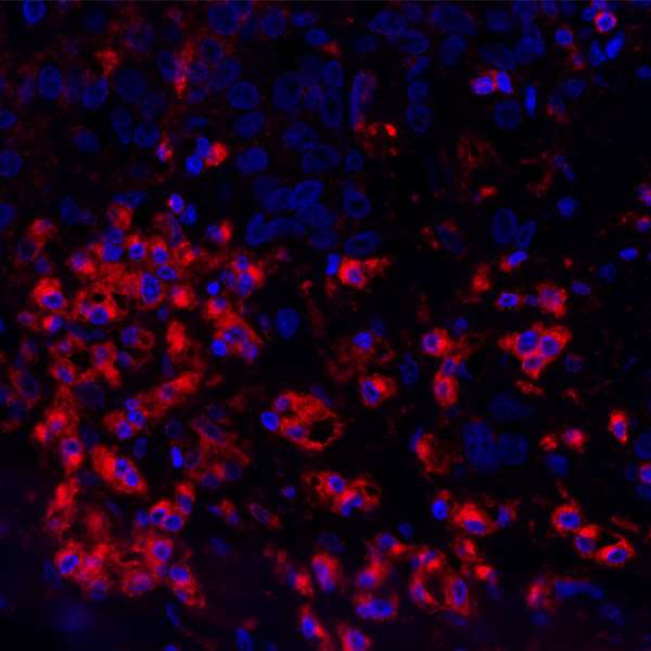 Immunohistochemistry (Formalin/PFA-fixed paraffin-embedded sections) - Anti-VISTA antibody [BLR035F] - BSA free (ab272080), expandable thumbnail