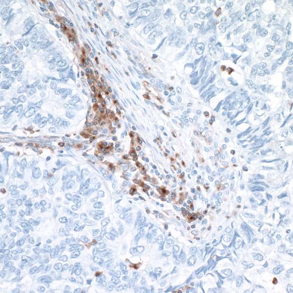 Immunohistochemistry (Formalin/PFA-fixed paraffin-embedded sections) - Anti-VISTA antibody [BLR035F] - BSA free (AB272080), expandable thumbnail