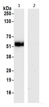 Immunoprecipitation - Anti-VISTA antibody [BLR035F] - BSA free (AB272080), expandable thumbnail