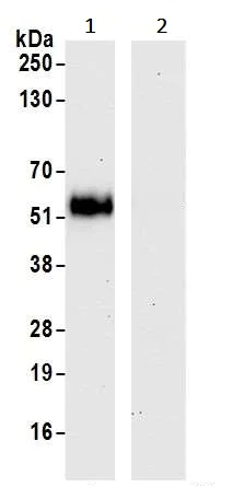 Immunoprecipitation - Anti-VISTA antibody [BLR035F] - BSA free (AB272080)