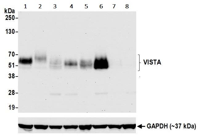 Western blot - Anti-VISTA antibody [BLR035F] - BSA free (AB272080), expandable thumbnail