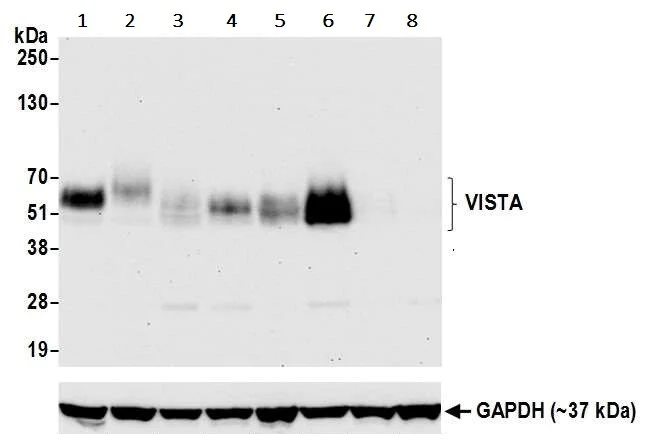 Western blot - Anti-VISTA antibody [BLR035F] - BSA free (AB272080)