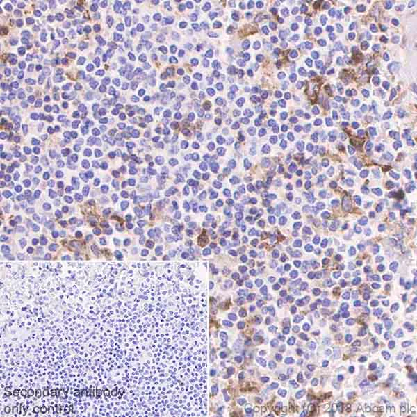 Immunohistochemistry (Formalin/PFA-fixed paraffin-embedded sections) - Anti-VISTA antibody [EPR21050] (AB230950)