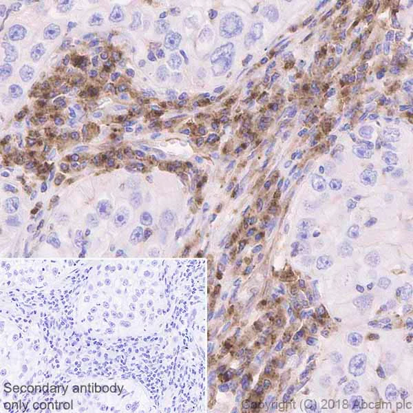 Immunohistochemistry (Formalin/PFA-fixed paraffin-embedded sections) - Anti-VISTA antibody [EPR21050] (AB230950)
