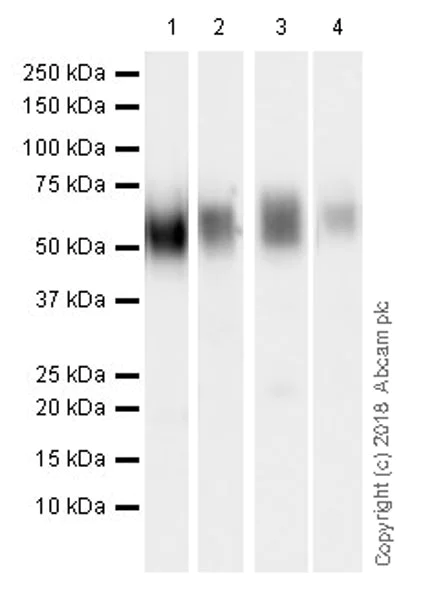 Western blot - Anti-VISTA antibody [EPR21050] (AB230950)