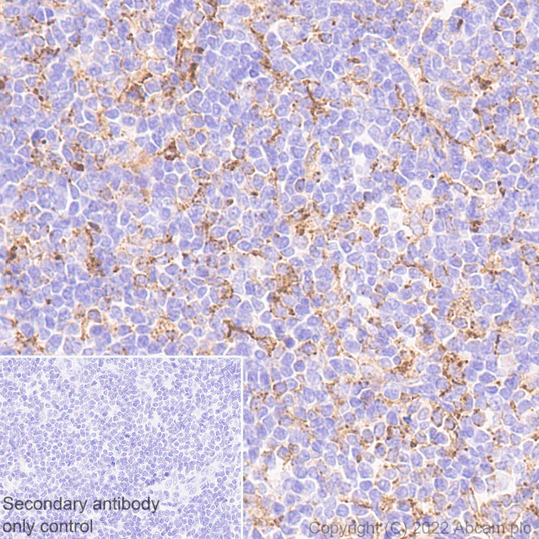 Immunohistochemistry (Formalin/PFA-fixed paraffin-embedded sections) - Anti-VISTA antibody [EPR25068-124] (AB300042)