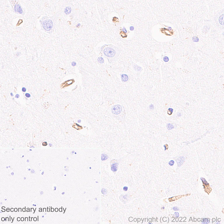 Immunohistochemistry (Formalin/PFA-fixed paraffin-embedded sections) - Anti-VISTA antibody [EPR25068-124] (AB300042)
