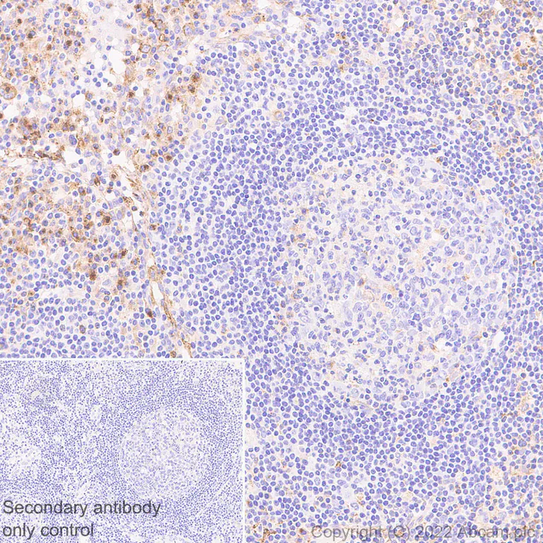 Immunohistochemistry (Formalin/PFA-fixed paraffin-embedded sections) - Anti-VISTA antibody [EPR25068-124] (AB300042)