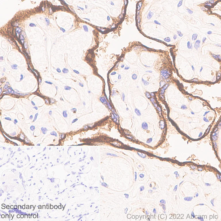 Immunohistochemistry (Formalin/PFA-fixed paraffin-embedded sections) - Anti-VISTA antibody [EPR25068-124] (AB300042)