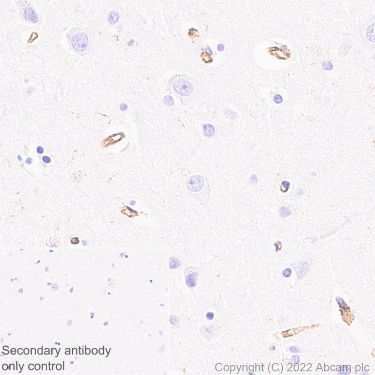 Immunohistochemistry (Formalin/PFA-fixed paraffin-embedded sections) - Anti-VISTA antibody [EPR25068-124] (AB300042)