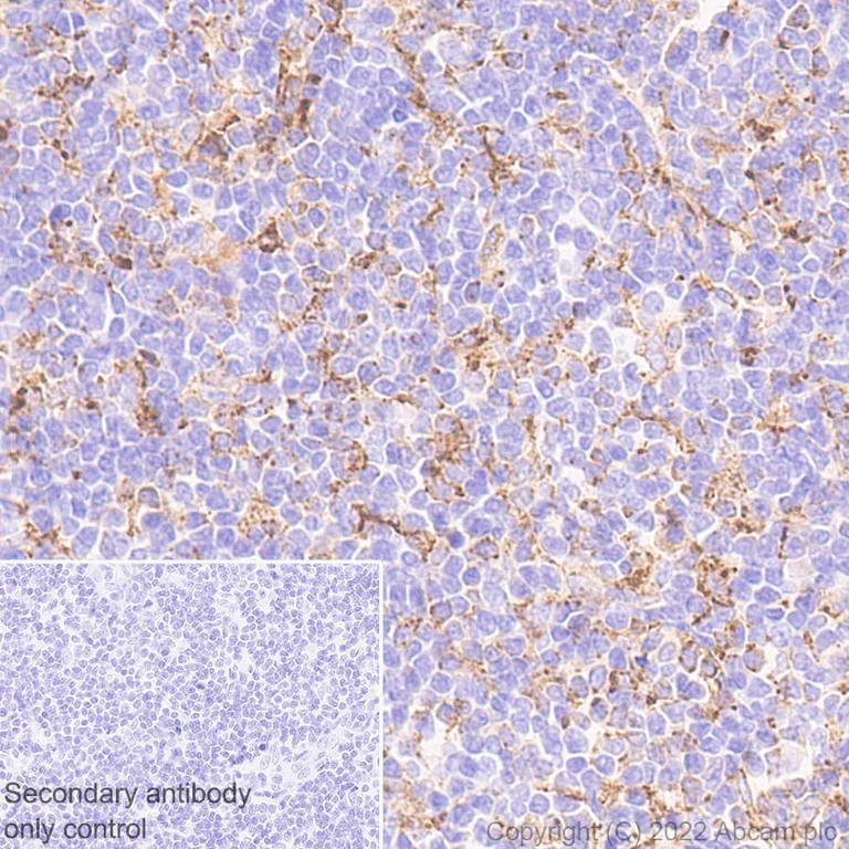 Immunohistochemistry (Formalin/PFA-fixed paraffin-embedded sections) - Anti-VISTA antibody [EPR25068-124] (AB300042)