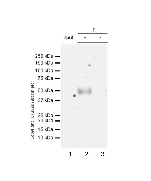 Immunoprecipitation - Anti-VISTA antibody [EPR25068-124] (AB300042)