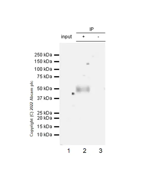 Immunoprecipitation - Anti-VISTA antibody [EPR25068-124] (AB300042)