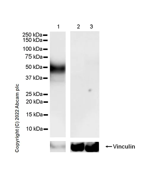 Western blot - Anti-VISTA antibody [EPR25068-124] (AB300042)