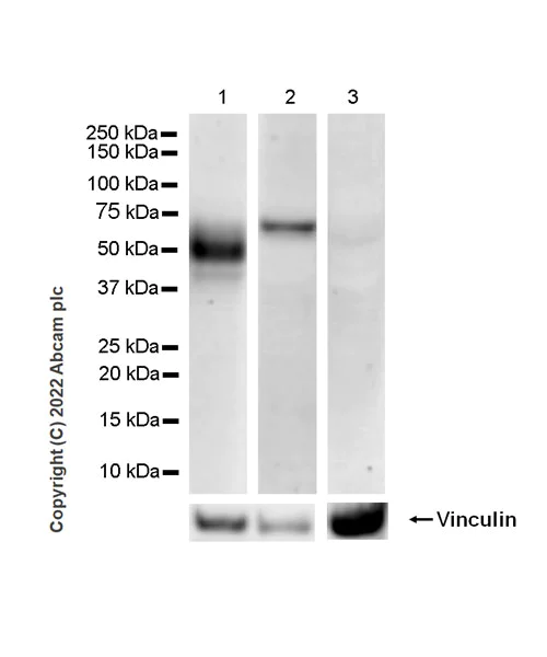 Western blot - Anti-VISTA antibody [EPR25068-124] (AB300042)