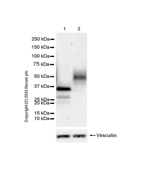 Western blot - Anti-VISTA antibody [EPR25068-124] (AB300042)