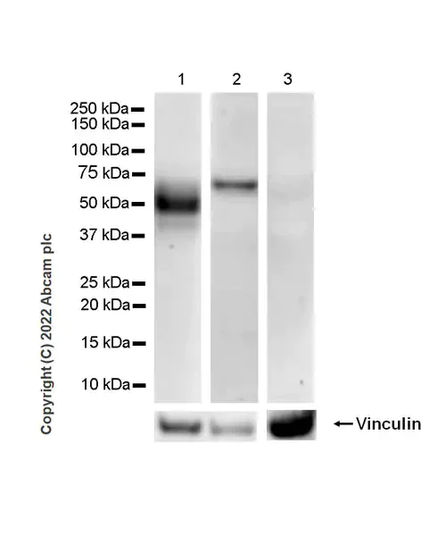 Western blot - Anti-VISTA antibody [EPR25068-124] (AB300042)