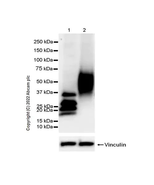 Western blot - Anti-VISTA antibody [EPR25068-124] (AB300042)