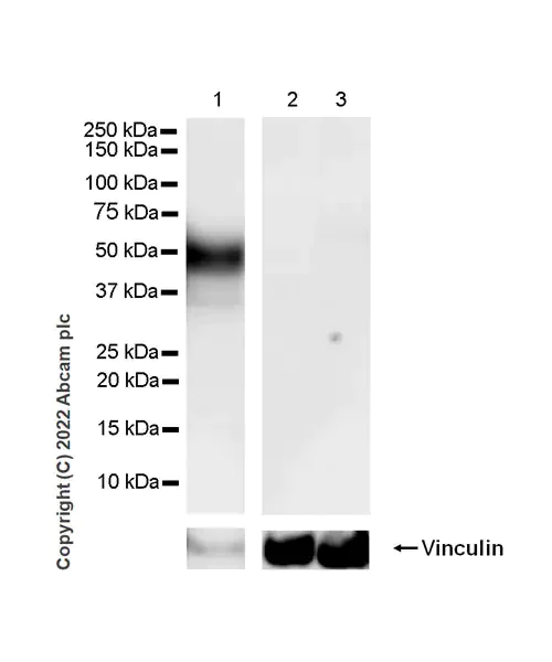 Western blot - Anti-VISTA antibody [EPR25068-124] (AB300042)