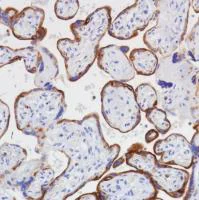 Immunohistochemistry (Formalin/PFA-fixed paraffin-embedded sections) - Anti-VISTA antibody [SP345] (AB217266)