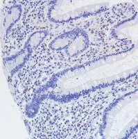 Immunohistochemistry (Formalin/PFA-fixed paraffin-embedded sections) - Anti-VISTA antibody [SP345] (AB217266)