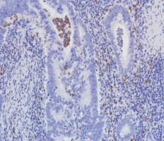 Immunohistochemistry (Formalin/PFA-fixed paraffin-embedded sections) - Anti-VISTA antibody [SP345] (AB217266)