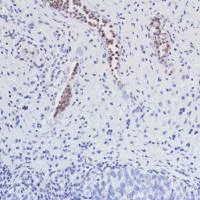 Immunohistochemistry (Formalin/PFA-fixed paraffin-embedded sections) - Anti-VISTA antibody [SP345] (AB217266)