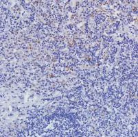 Immunohistochemistry (Formalin/PFA-fixed paraffin-embedded sections) - Anti-VISTA antibody [SP345] (AB217266)