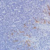 Immunohistochemistry (Formalin/PFA-fixed paraffin-embedded sections) - Anti-VISTA antibody [SP345] (AB217266)