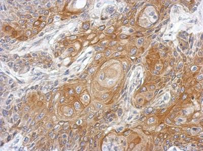 Immunohistochemistry (Formalin/PFA-fixed paraffin-embedded sections) - Anti-Vitamin D Binding protein antibody (AB153922), expandable thumbnail