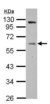 Western blot - Anti-Vitamin D Binding protein antibody (AB153922)