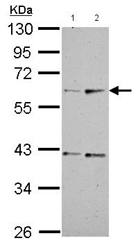 Western blot - Anti-Vitamin D Binding protein antibody (AB153922), expandable thumbnail