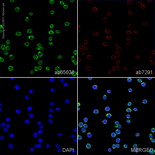 Immunocytochemistry/ Immunofluorescence - Anti-Vitamin D Binding protein antibody (AB65636)